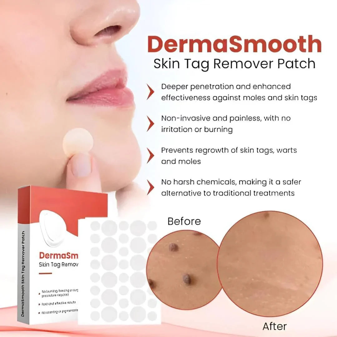 Derma Smooth Tag Remover