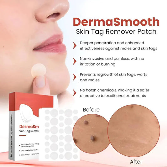 Derma Smooth Tag Remover